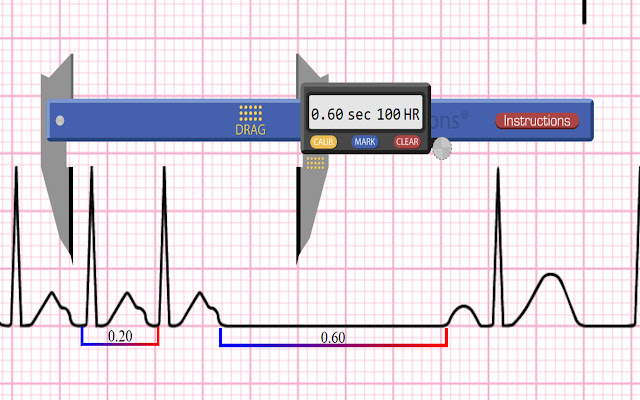 Apex EKG Caliper from Chrome web store to be run with OffiDocs Chromium online Apex EKG Caliper from Chrome web store to be run with OffiDocs Chromium online