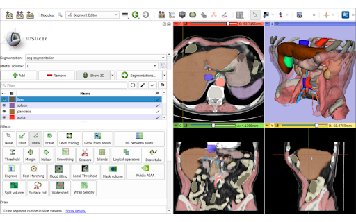 Kitware File Viewers from Chrome web store to be run with OffiDocs Chromium online Kitware File Viewers from Chrome web store to be run with OffiDocs Chromium online