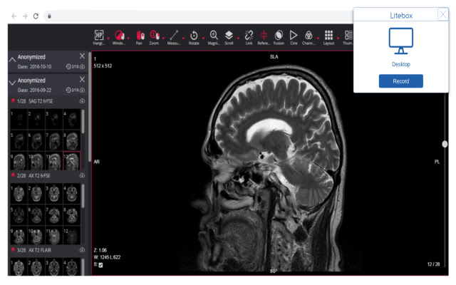 Litebox from Chrome web store to be run with OffiDocs Chromium online Litebox from Chrome web store to be run with OffiDocs Chromium online